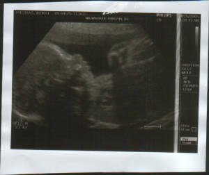 ultrasound27weeks.jpg