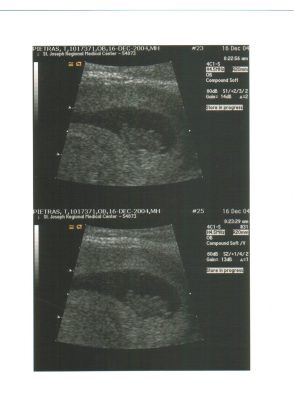 ultrasound.jpg